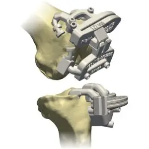 Patient-Specific-400x400